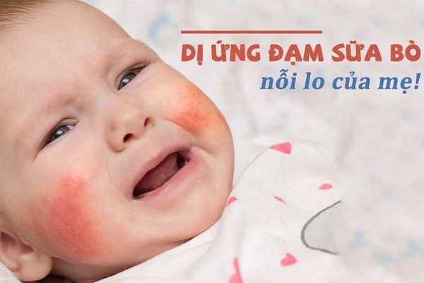 thực đơn cho bé bị dị ứng