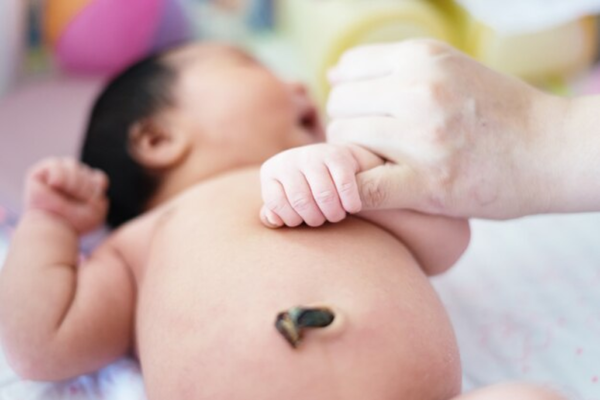 10 ngày đầu đời, mẹ cần biết cách vệ sinh rốn cho bé 2 vệ sinh rốn cho bé