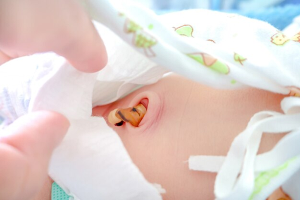10 ngày đầu đời, mẹ cần biết cách vệ sinh rốn cho bé 4 vệ sinh rốn cho bé